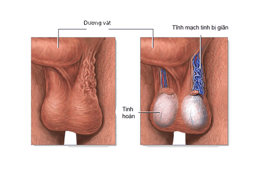 ĐỊA CHỈ KHÁM CHỮA ĐAU TINH HOÀN UY TÍN
